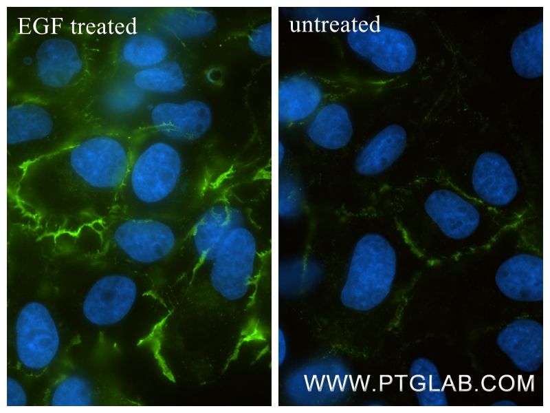 IF Staining of A431 using 87084-2-RR (same clone as 87084-2-PBS) IF Staining of A431 using 87084-2-RR (same clone as 87084-2-PBS)