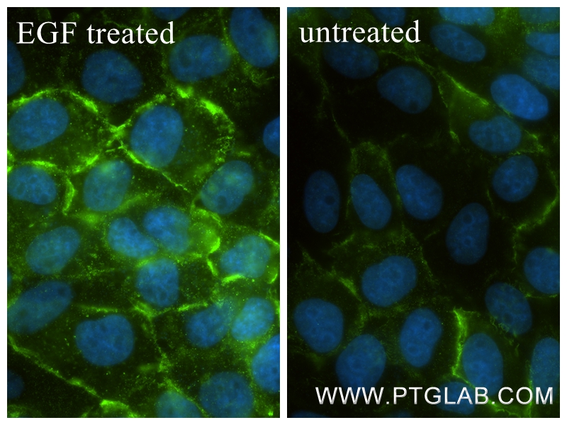 Immunofluorescent analysis of (4% PFA) fixed EGF treated A431 cells using Phospho-EGFR (<a class='green' href='/productredirect?CatalogNo=Tyr1197' target='_blank'>Tyr1197</a>) antibody (84906-1-RR, Clone: 241826G10 ) at dilution of 1:500 and CoraLite®488-Conjugated Goat Anti-Rabbit IgG(H+L) (<a class='green' href='/productredirect?CatalogNo=SA00013-2' target='_blank'>SA00013-2</a>). IF Staining of A431 using 84906-1-RR