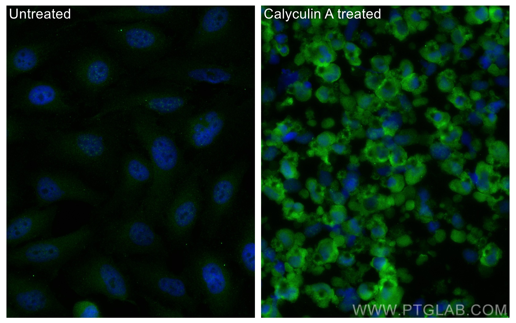 IF Staining of HeLa using 68023-1-Ig (same clone as 68023-1-PBS)