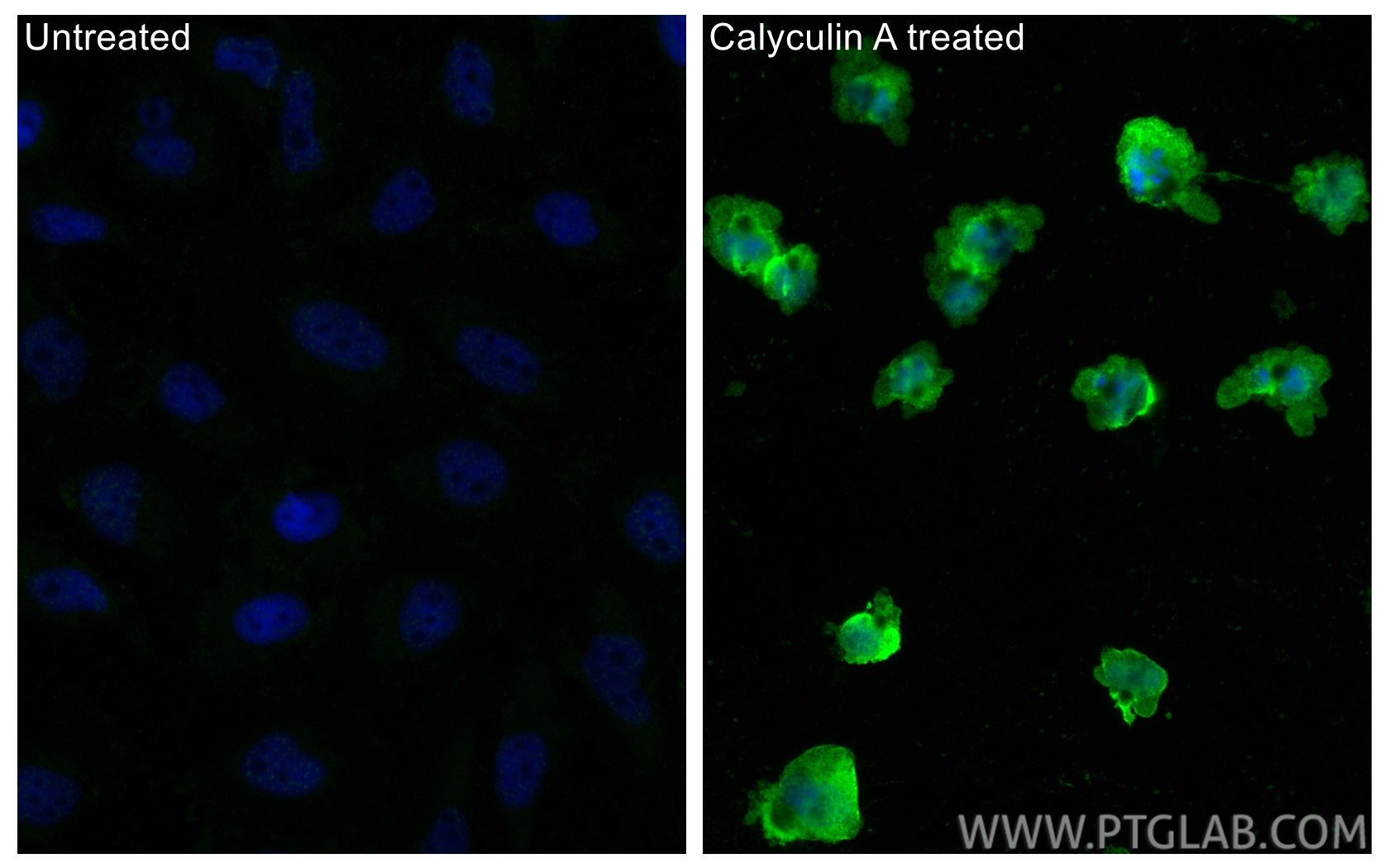 IF Staining of HeLa using 68023-1-Ig
