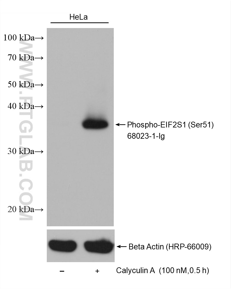 WB analysis using 68023-1-Ig (same clone as 68023-1-PBS)