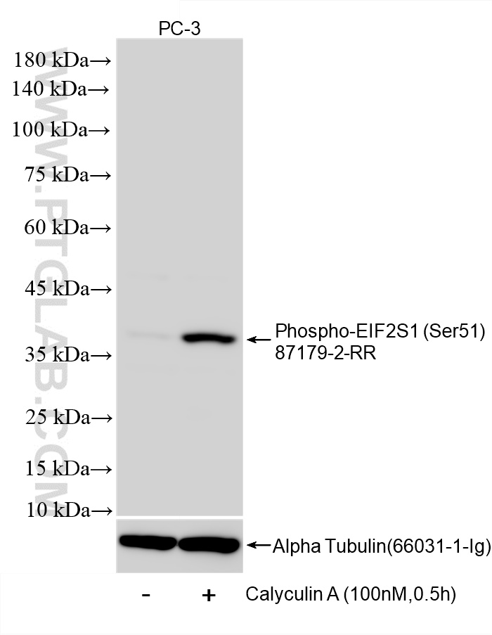 WB analysis of PC-3 using 87179-2-RR (same clone as 87179-2-PBS) WB analysis of PC-3 using 87179-2-RR (same clone as 87179-2-PBS)