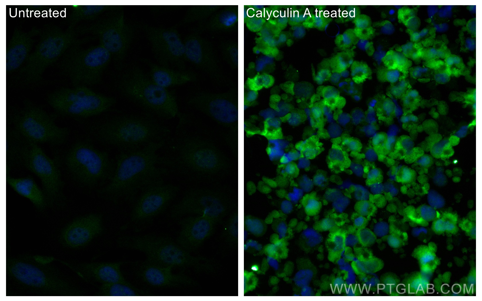 IF Staining of HeLa using CL488-68023