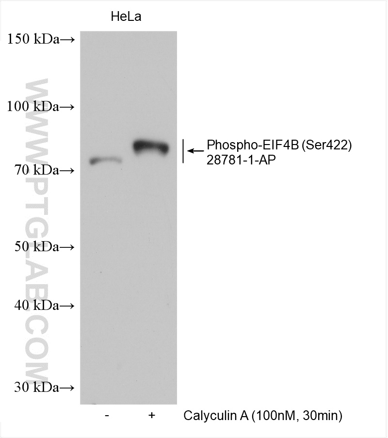 Phospho-EIF4B (Ser422)