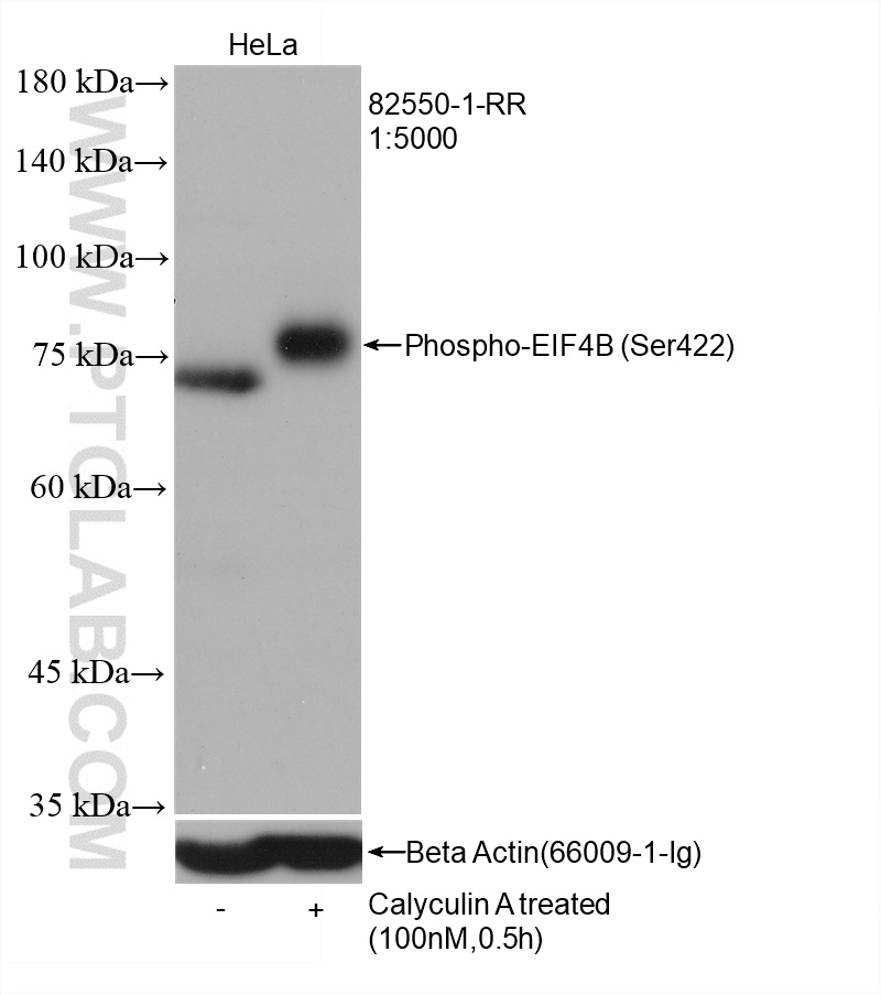 Phospho-EIF4B (Ser422)