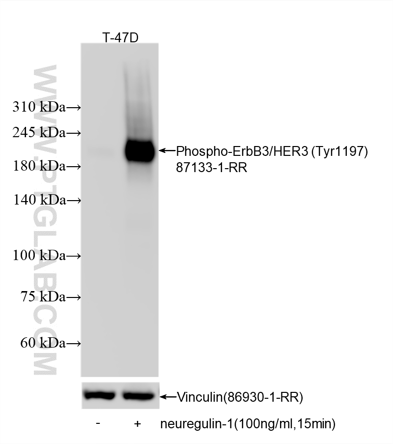 WB analysis of T-47D using 87133-1-RR