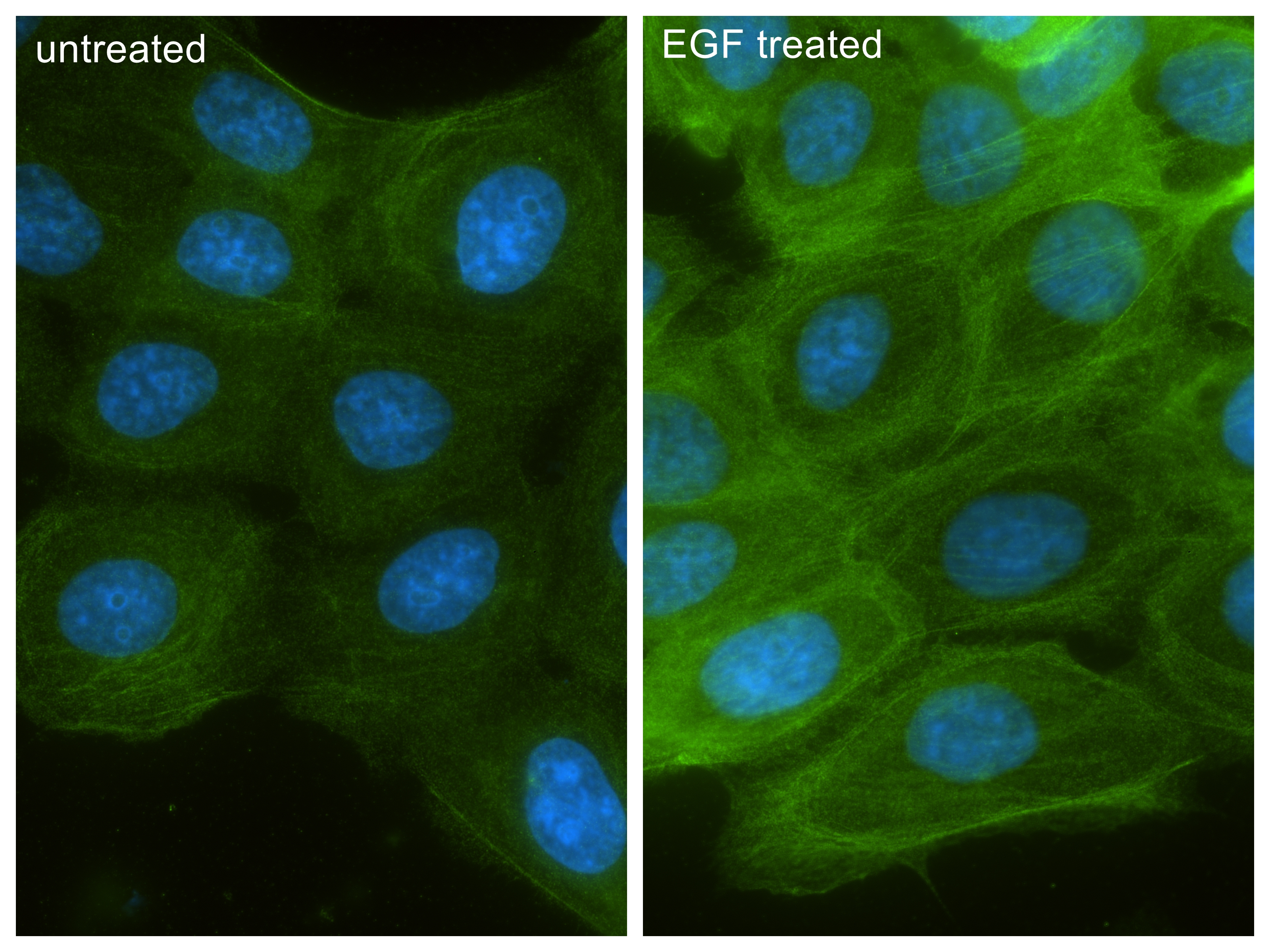 IF Staining of A431 using 87513-1-RR (same clone as 87513-1-PBS) IF Staining of A431 using 87513-1-RR (same clone as 87513-1-PBS)
