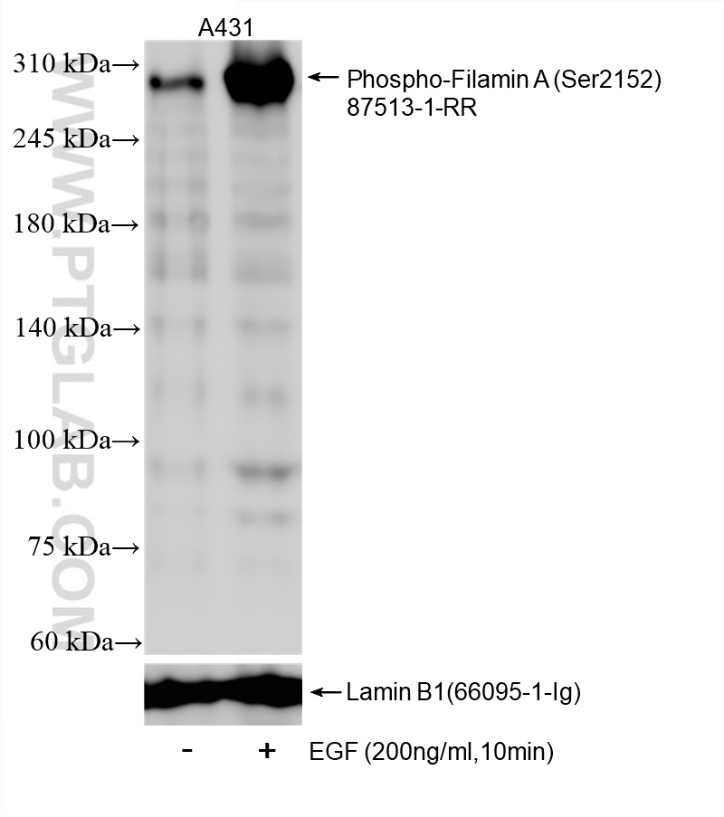 WB analysis of A431 using 87513-1-RR