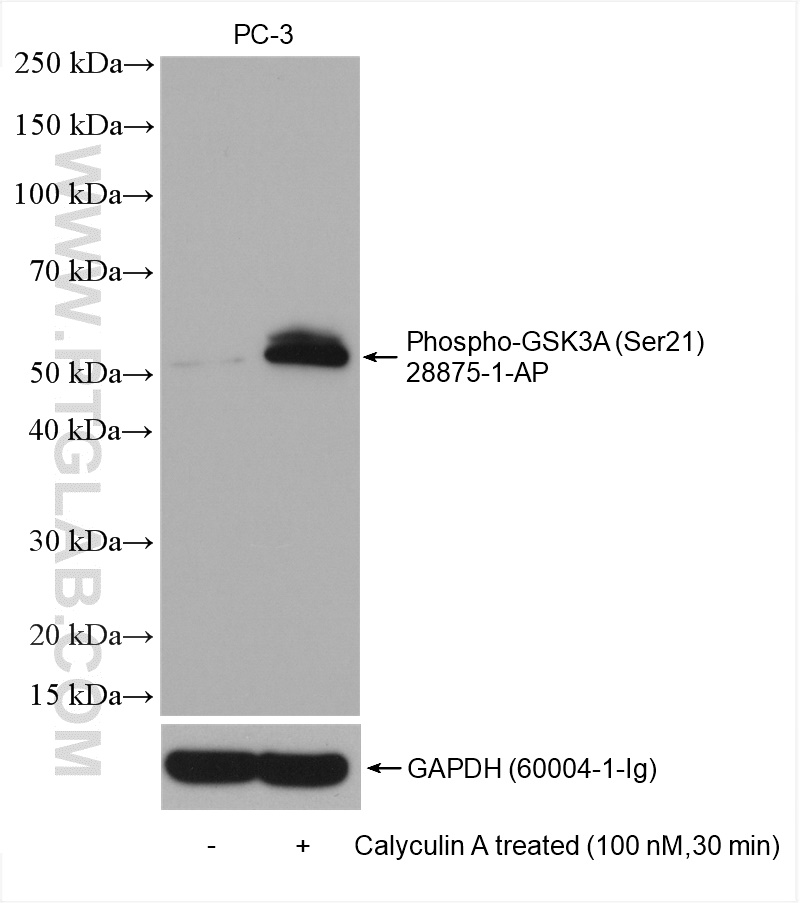 Phospho-GSK3A (Ser21)