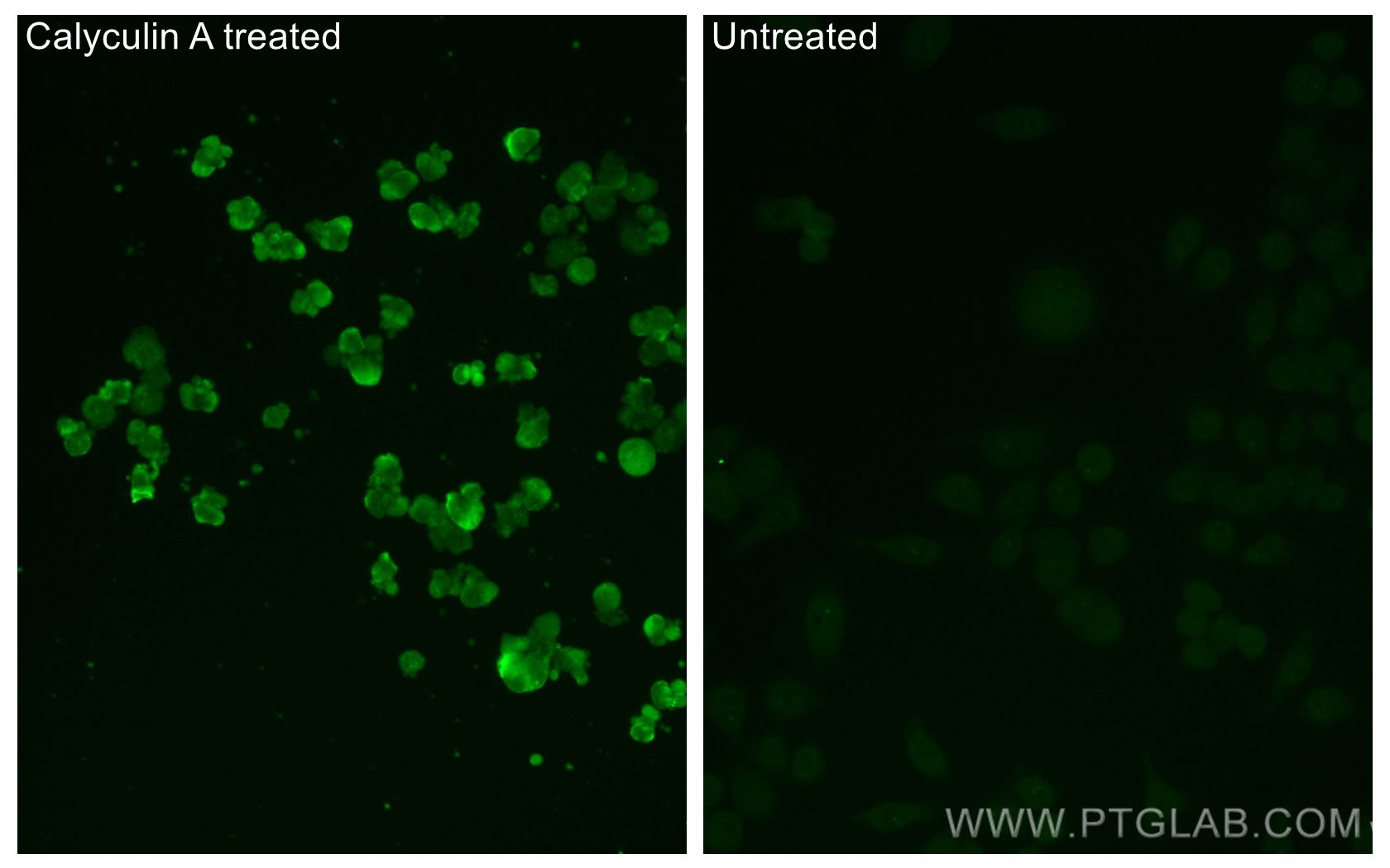 IF Staining of PC-3 using CL488-67558