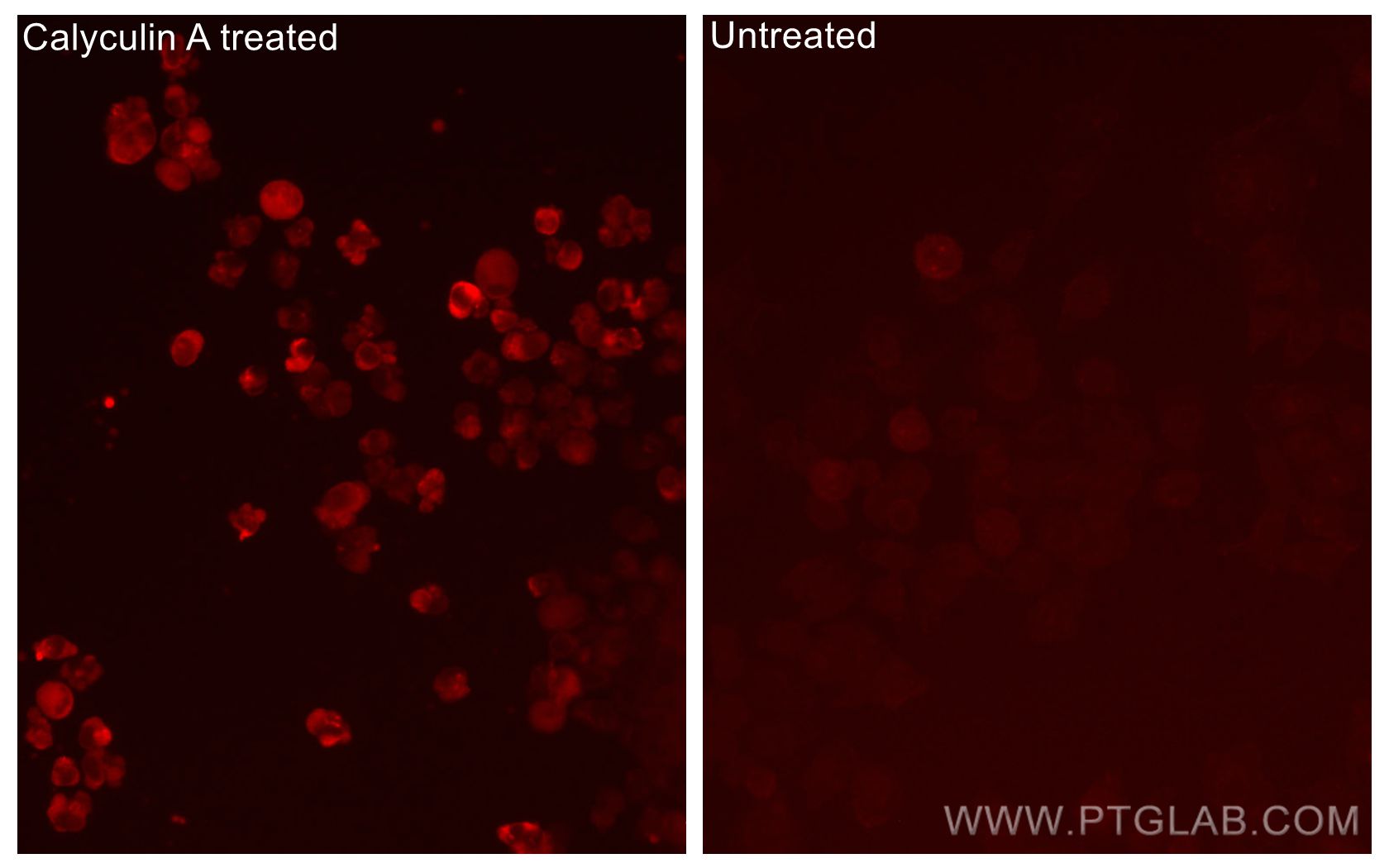 IF Staining of PC-3 using CL594-67558