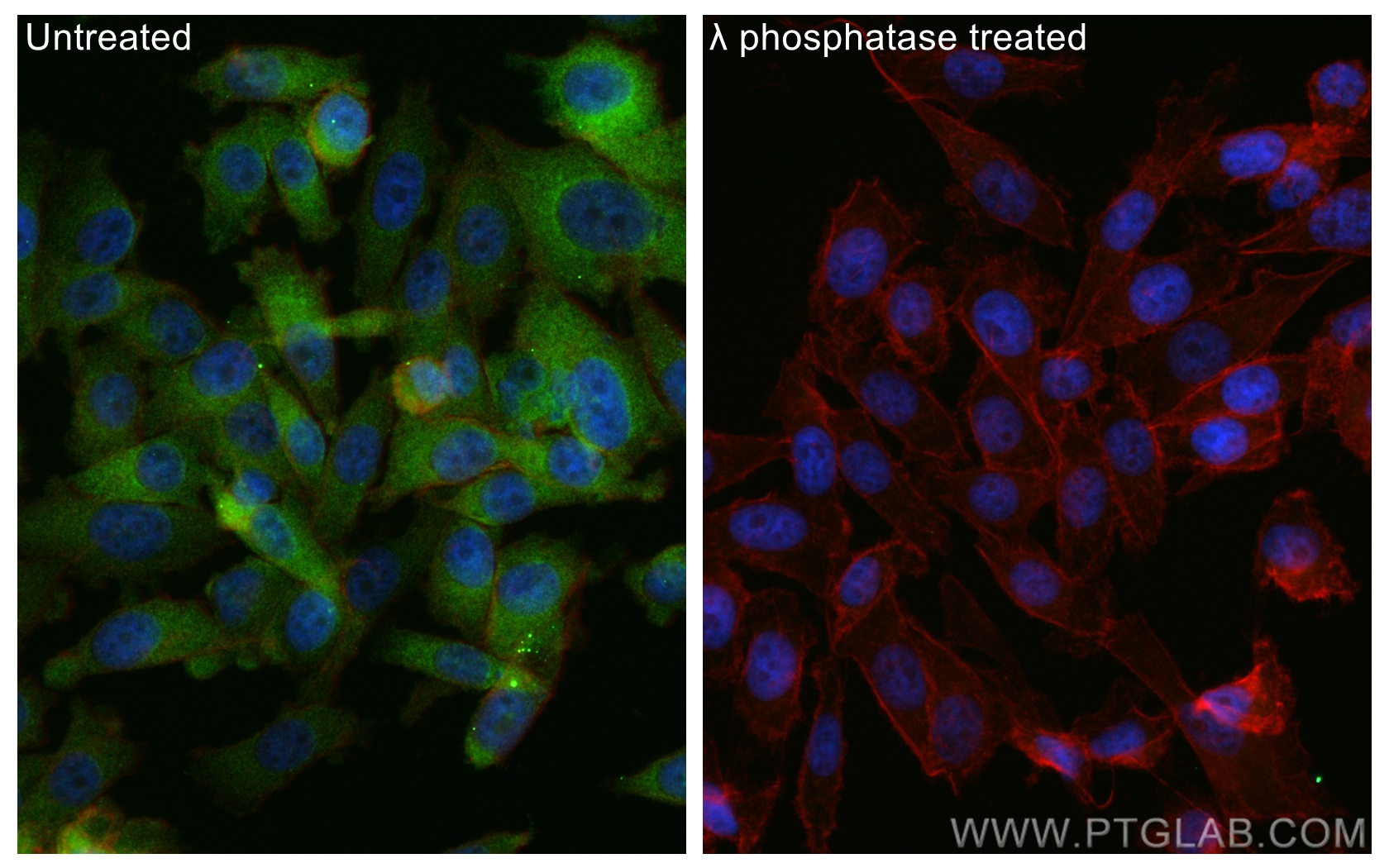 IF Staining of PC-3 using 28855-1-AP (same clone as 28855-1-PBS)