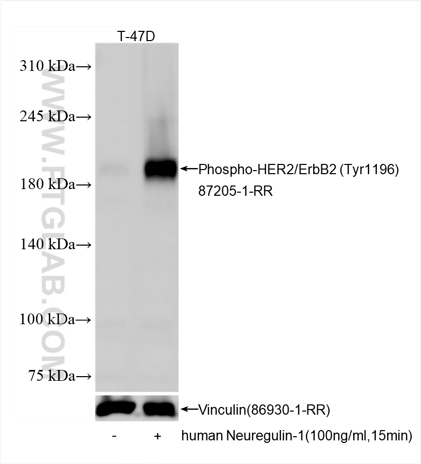 WB analysis of T-47D using 87205-1-RR