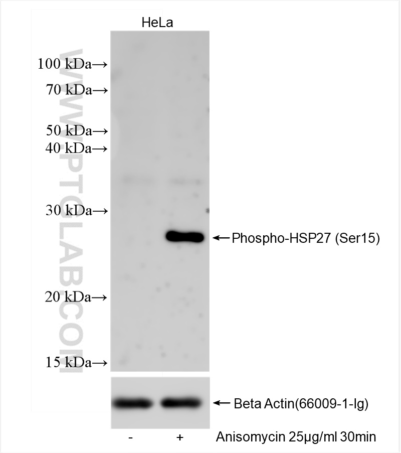 WB analysis of HeLa using 83332-1-RR