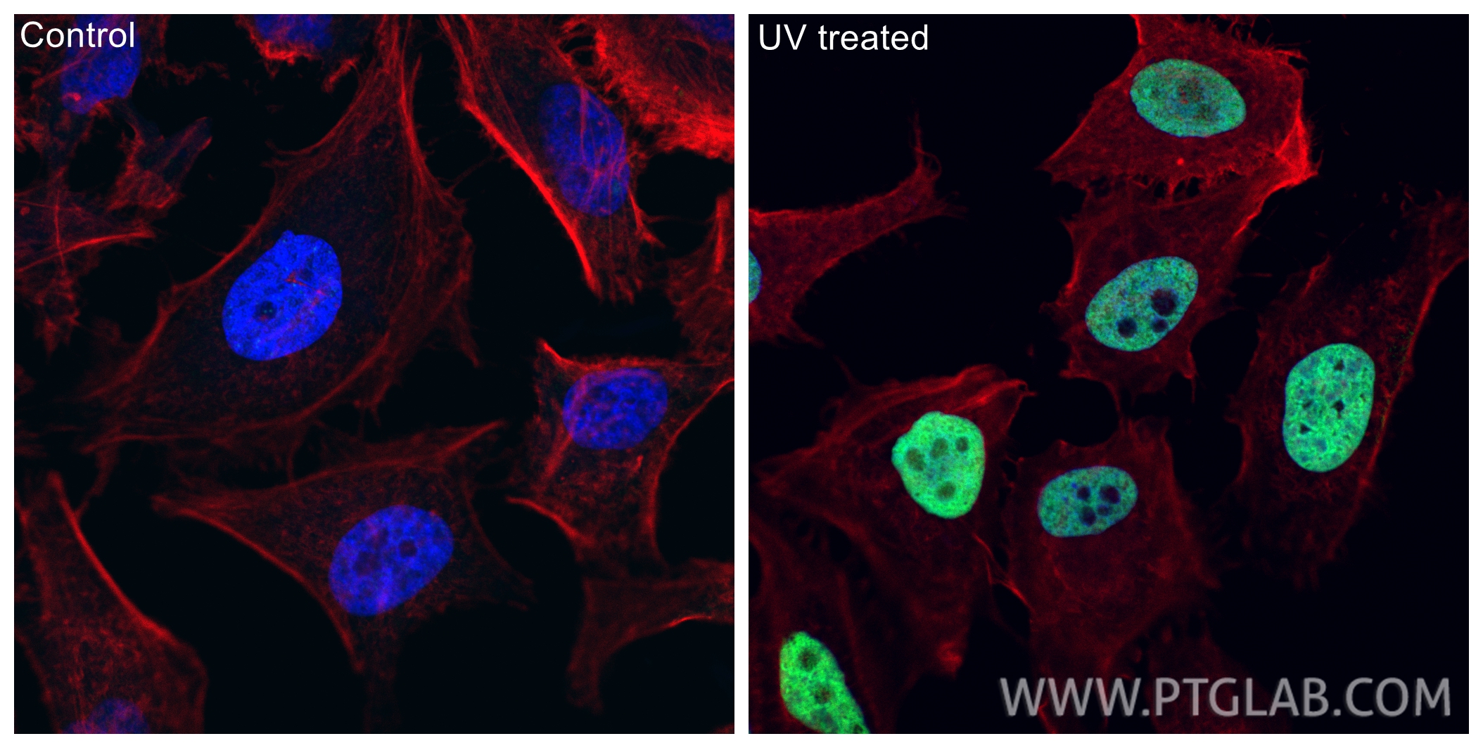 IF Staining of HeLa using 29380-1-AP