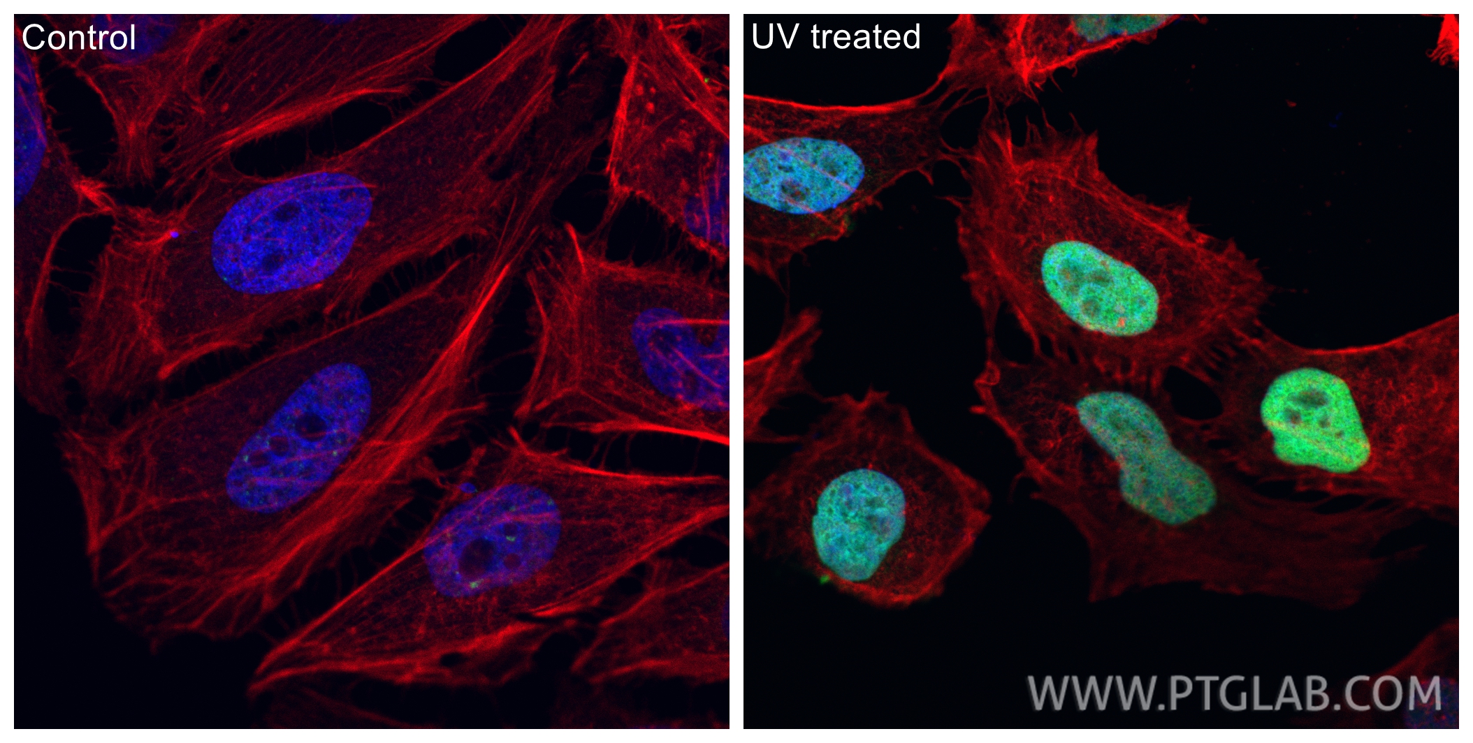 IF Staining of HeLa using 83307-2-RR