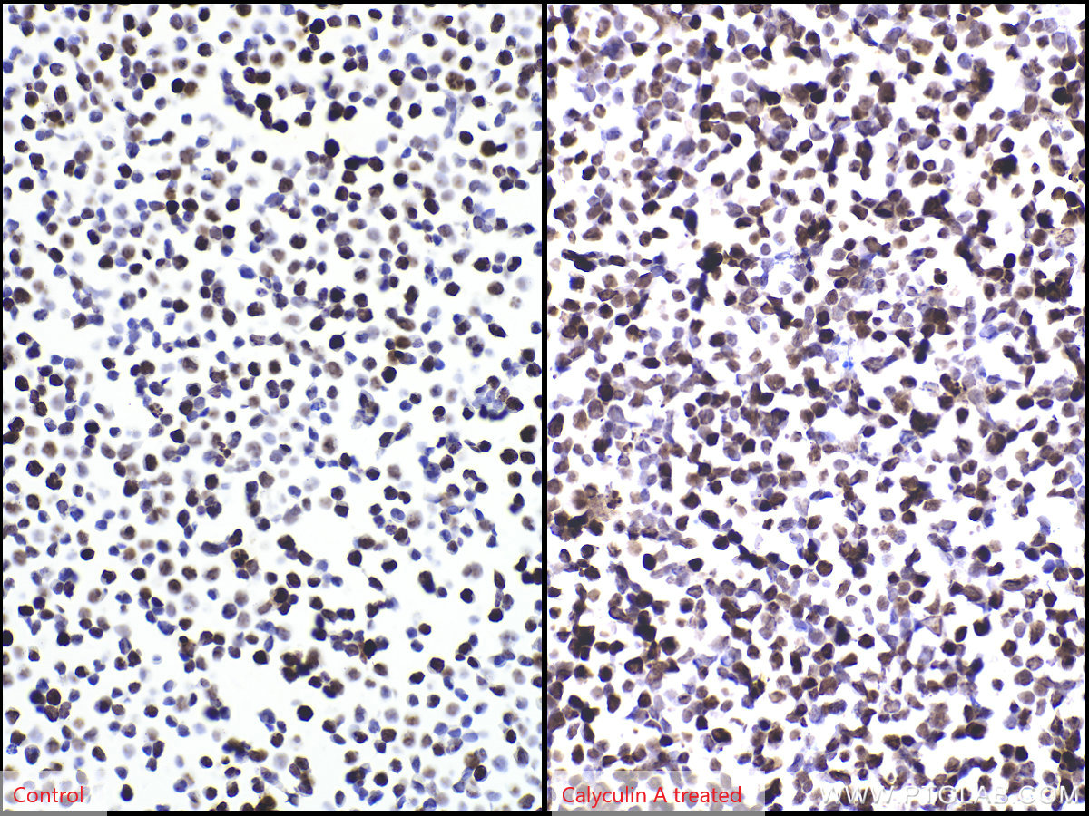 IHC staining of Jurkat using 83307-2-RR
