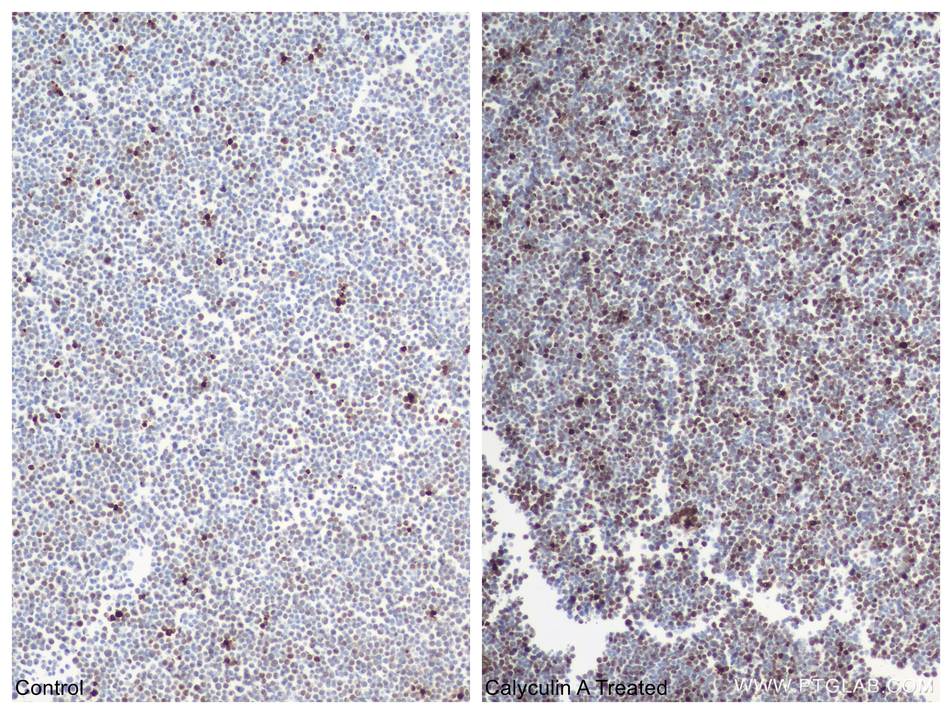 IHC staining of Jurkat using 83307-2-RR