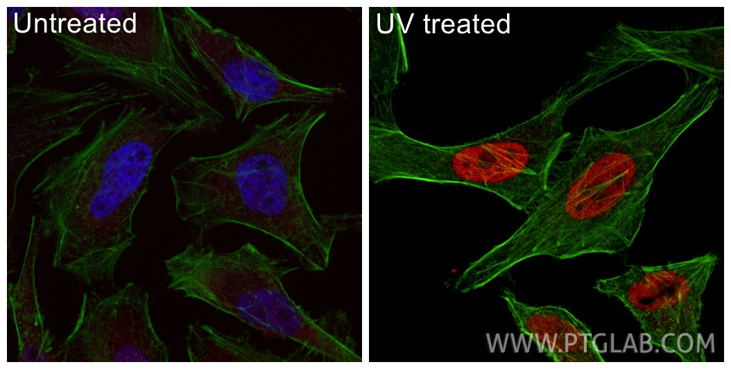 IF Staining of HeLa using CL594-83307-2