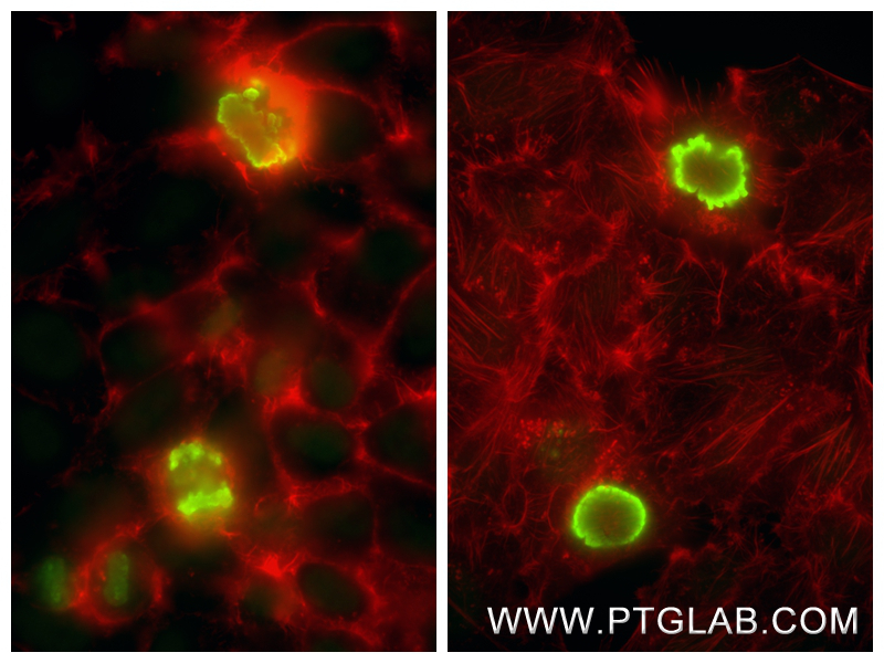 IF Staining of HepG2 using 82828-10-PBS IF Staining of HepG2 using 82828-10-PBS