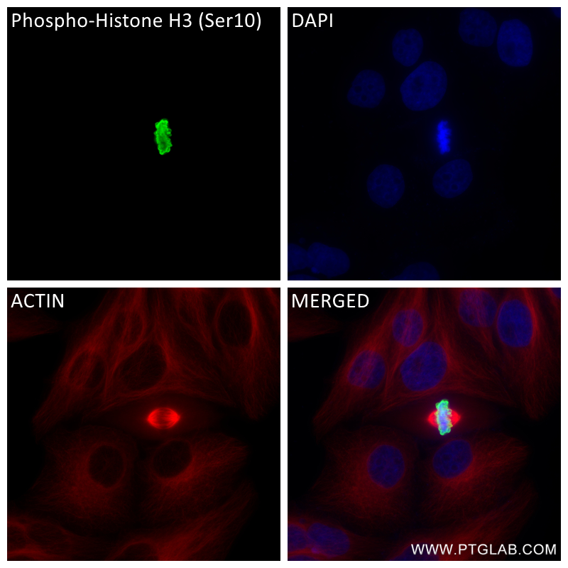 IF Staining of HepG2 using 82828-10-RR