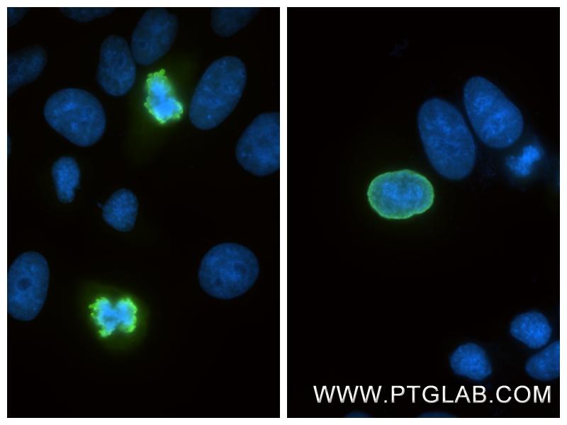 IF Staining of HepG2 using 82828-10-RR (same clone as 82828-10-PBS) IF Staining of HepG2 using 82828-10-RR (same clone as 82828-10-PBS)