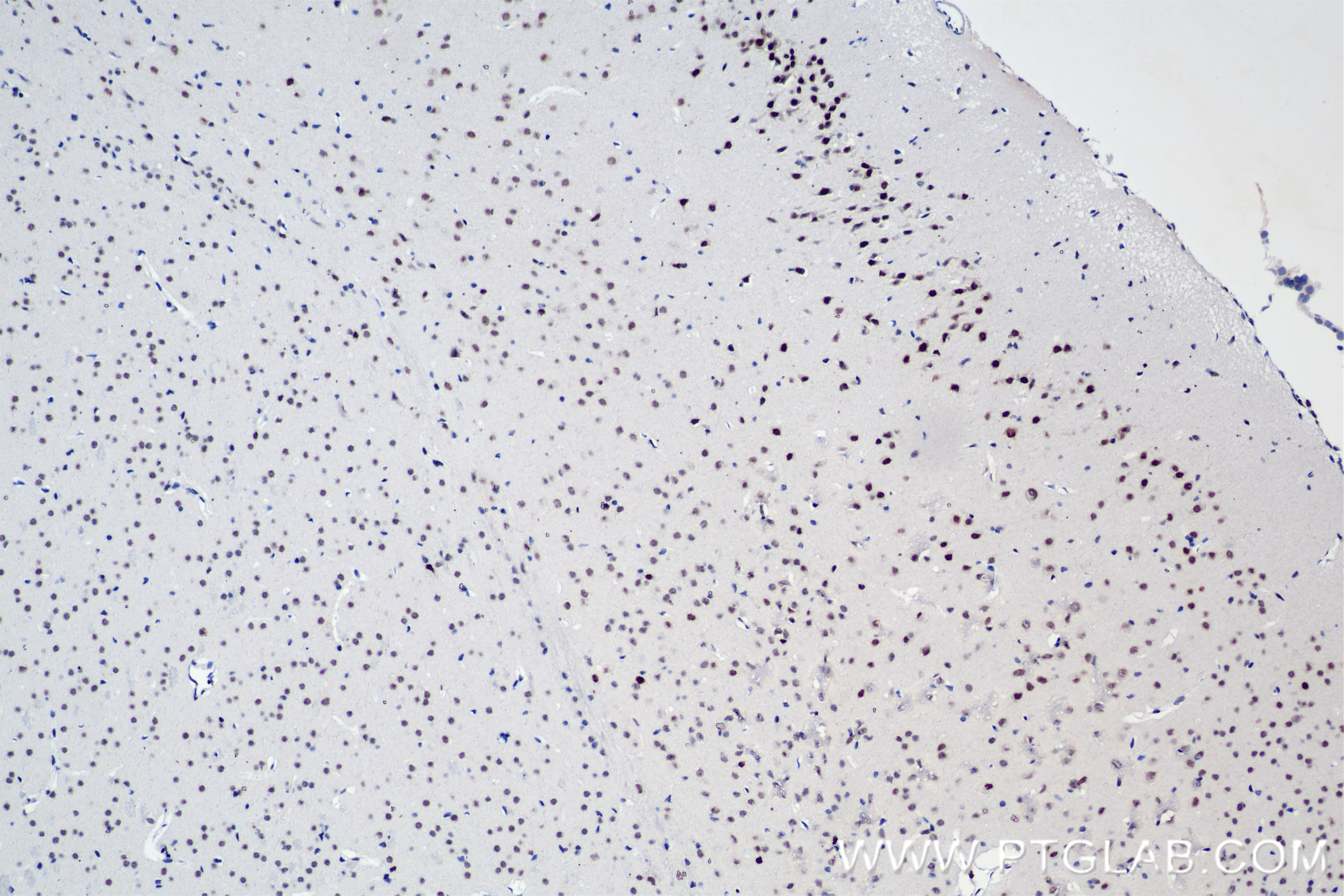 IHC staining of mouse brain using 82828-10-RR