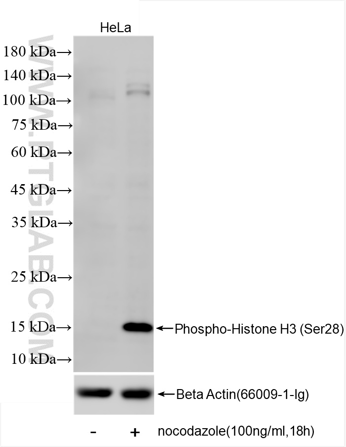 WB analysis of HeLa using 82828-15-RR