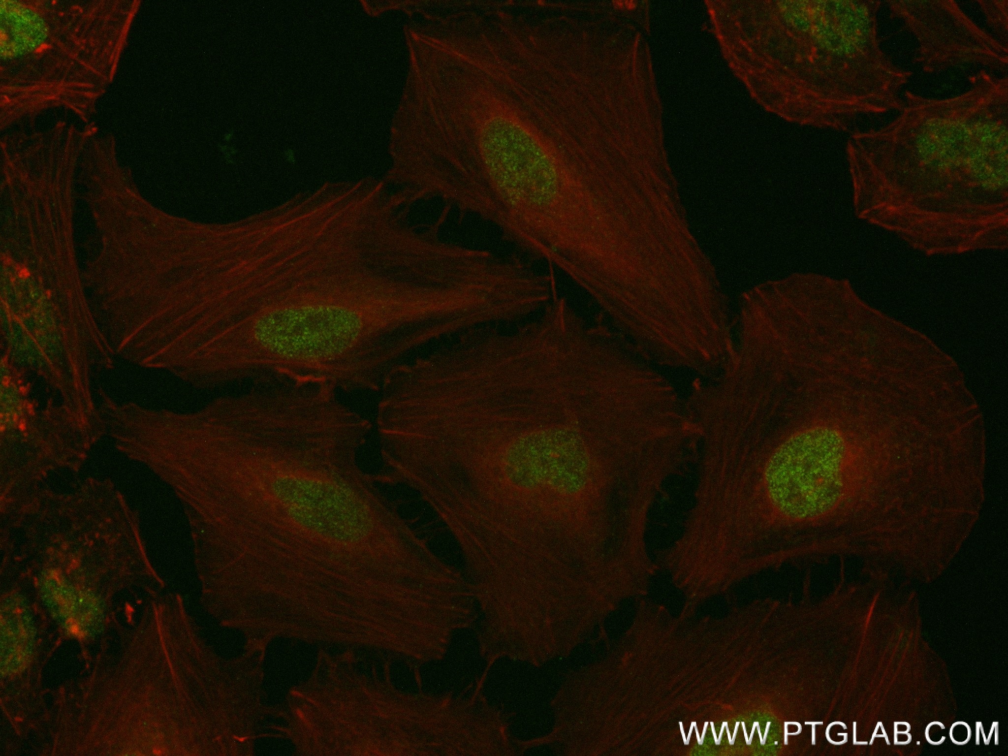 IF Staining of HeLa using 84739-1-RR (same clone as 84739-1-PBS)