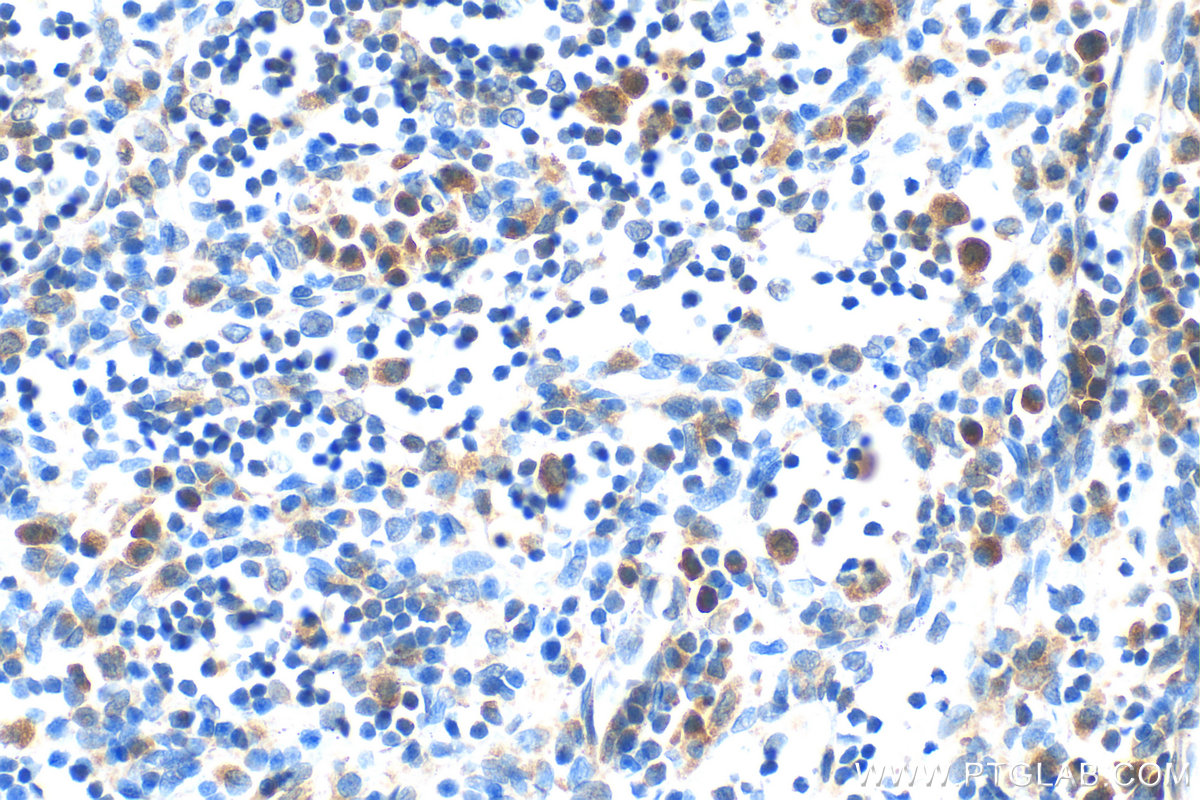 IHC staining of rat lymph node using 85753-1-RR