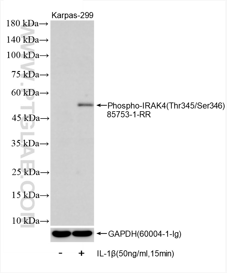 WB analysis of Karpas-299 using 85753-1-RR (same clone as 85753-1-PBS)