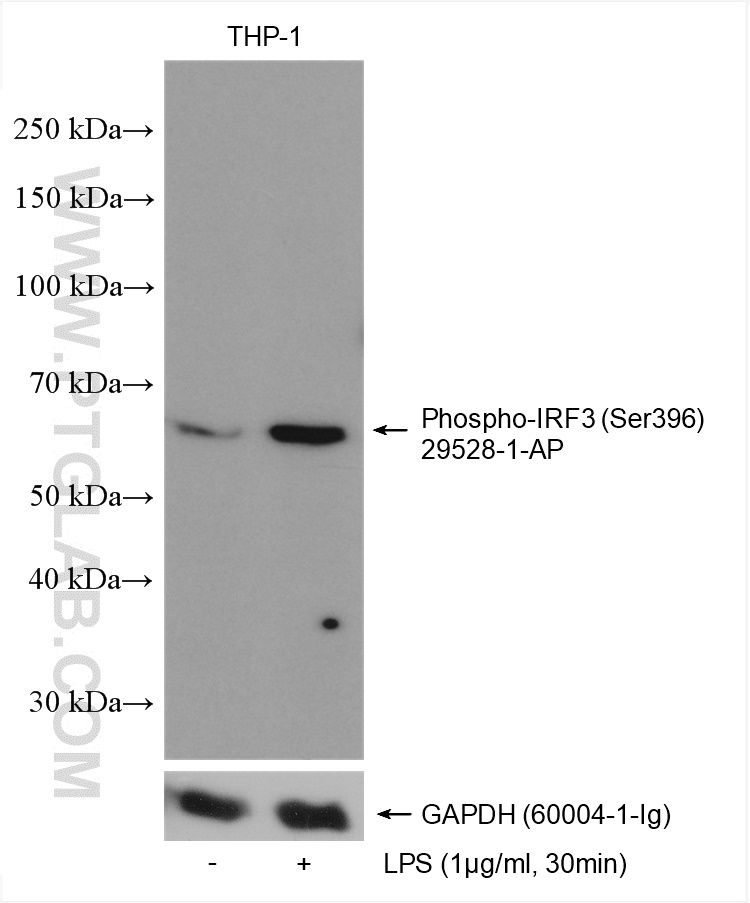 Phospho-IRF3 (Ser396)