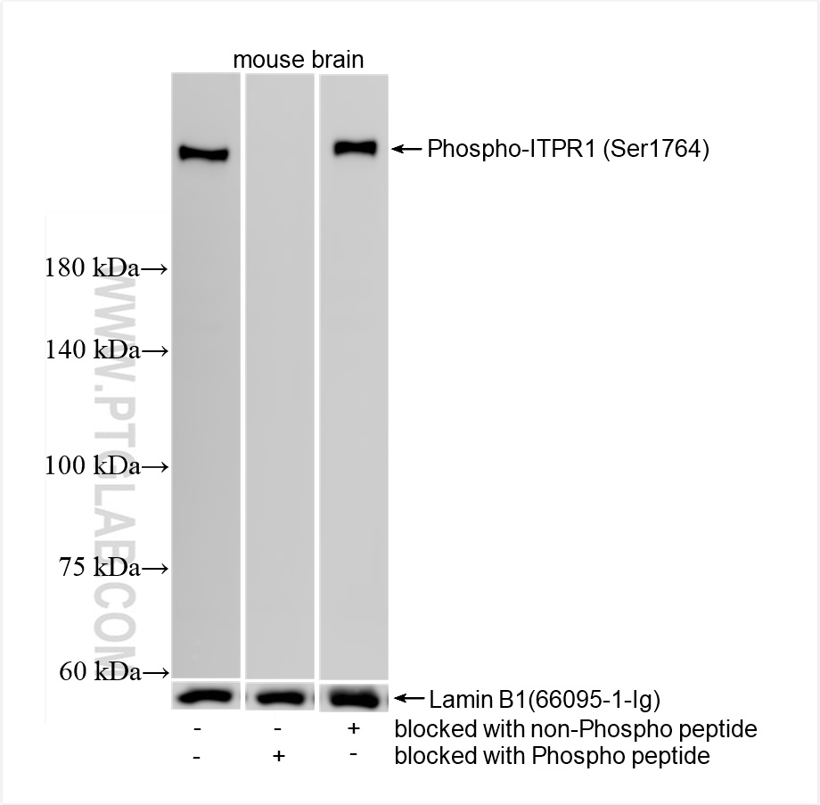WB analysis of mouse brain using 87294-1-RR (same clone as 87294-1-PBS)