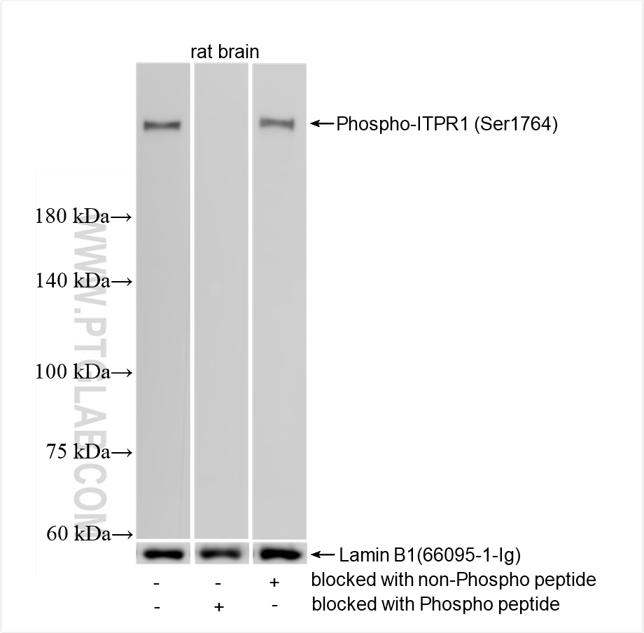WB analysis of rat brain using 87294-1-RR (same clone as 87294-1-PBS)