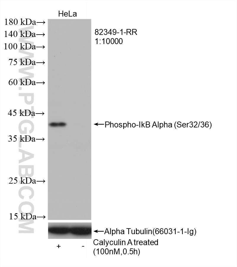 WB analysis of HeLa using 82349-1-RR