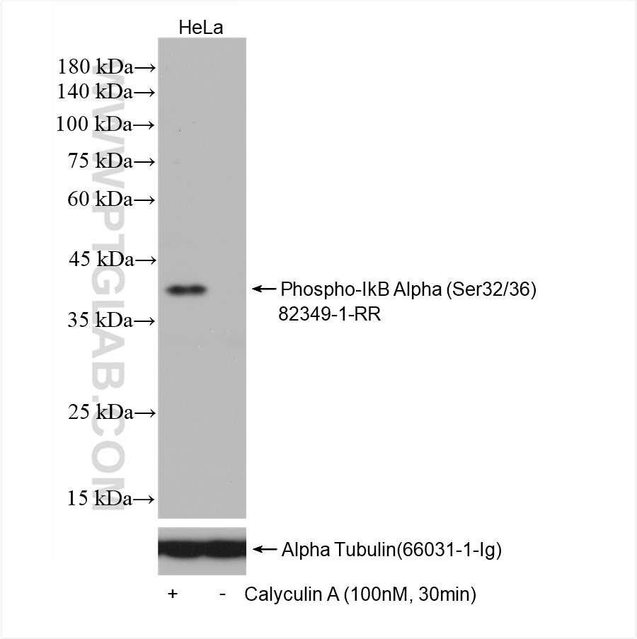 Phospho-IkB Alpha (Ser32/36)