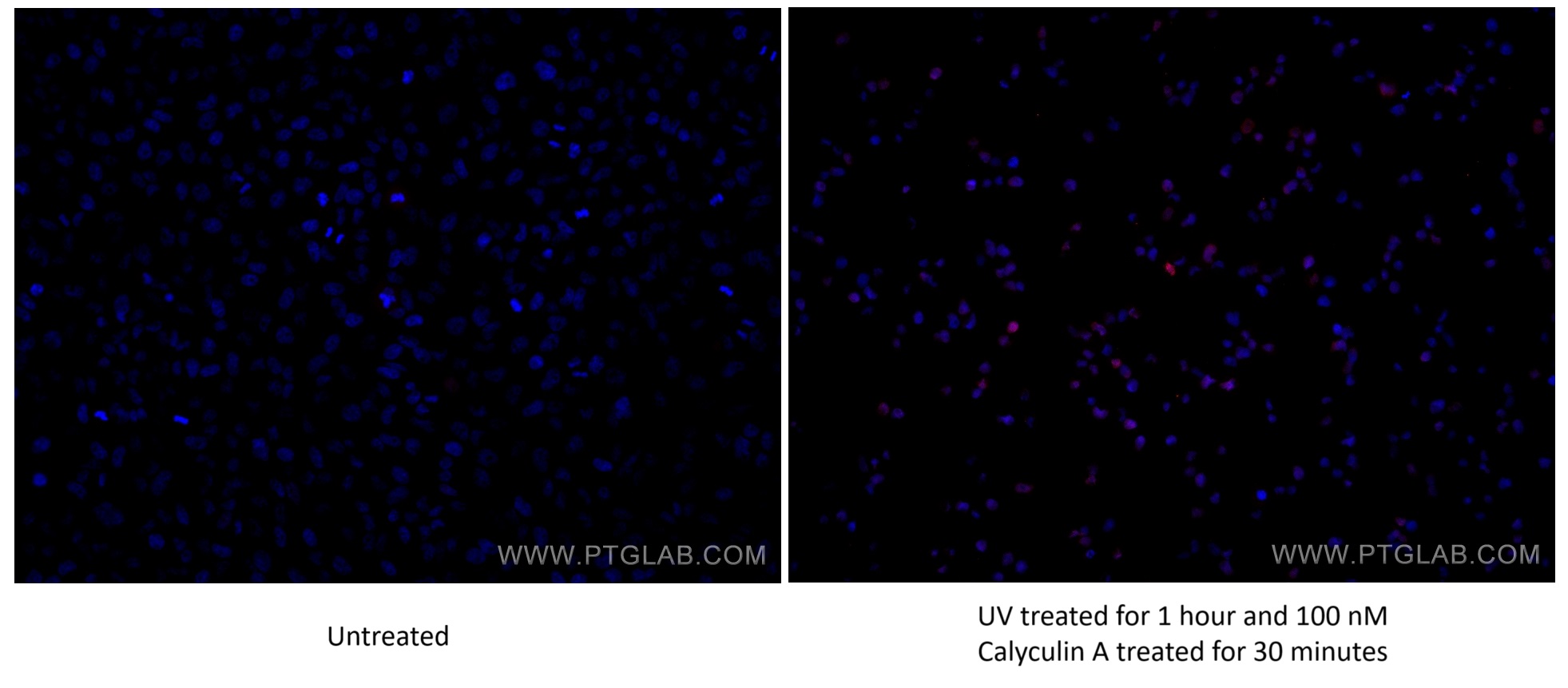 IF Staining of HeLa using 80086-1-RR