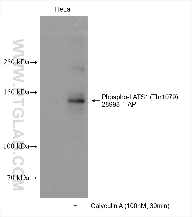 WB analysis using 28998-1-AP