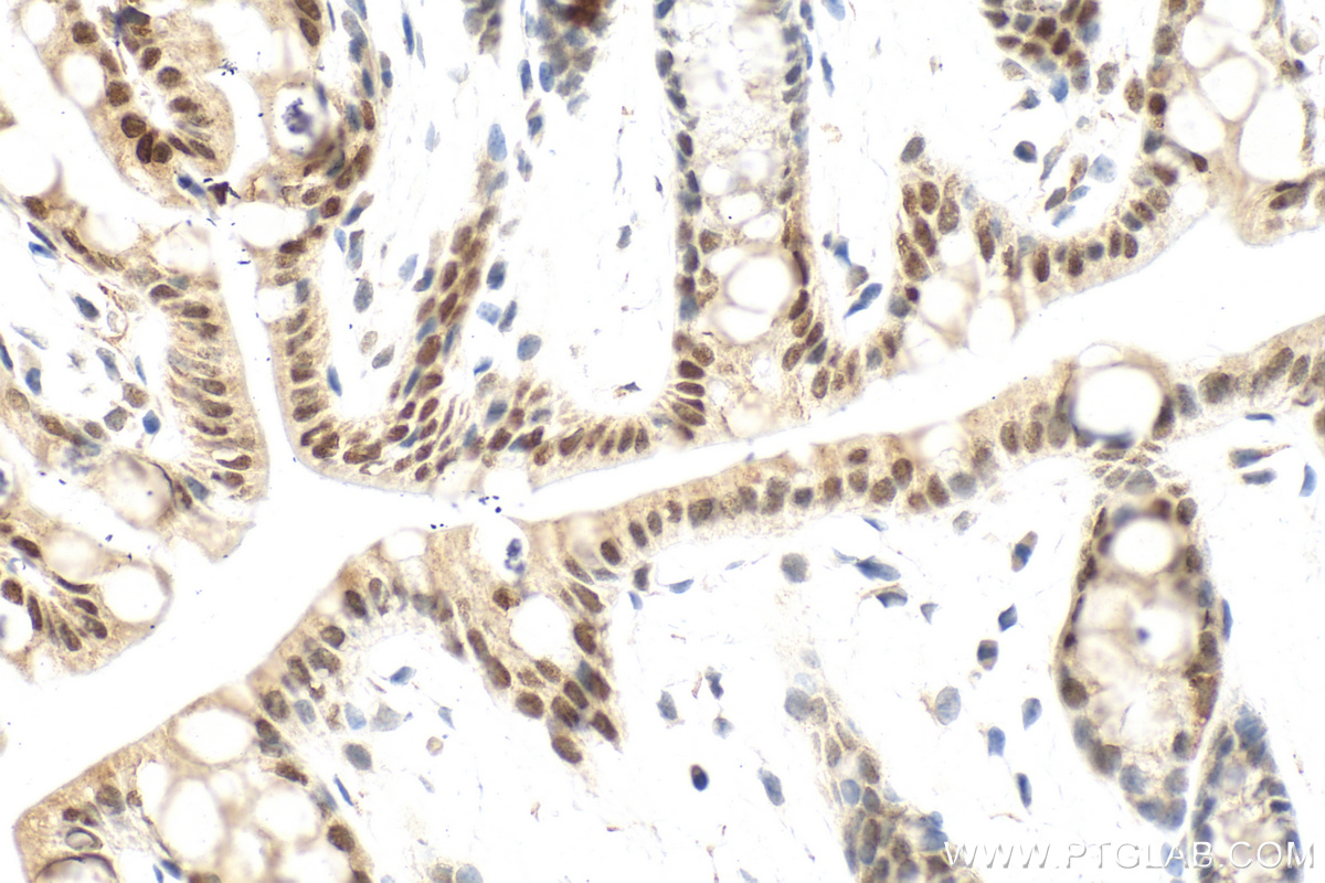 IHC staining of mouse colon using 87346-1-RR
