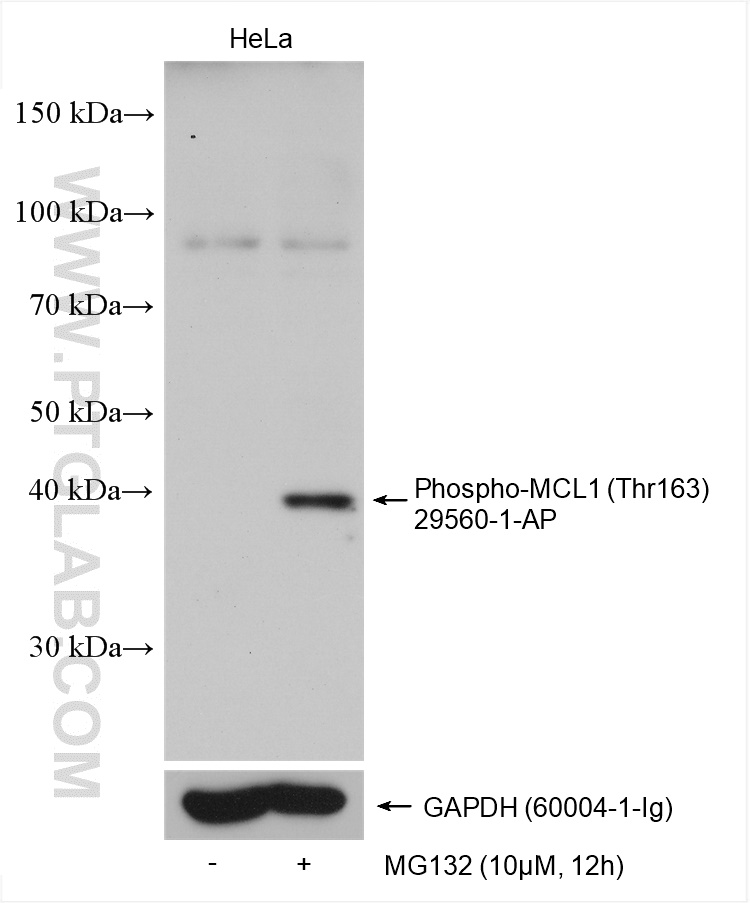 Phospho-MCL1 (Thr163)