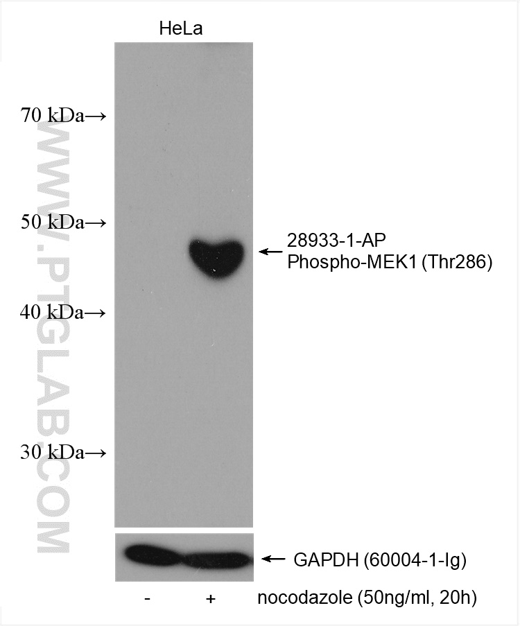 Non-treated HeLa cells and nocodazole treated HeLa cells were subjected to SDS PAGE followed by western blot with 28933-1-AP (Phospho-MEK1 (Thr286) antibody) at dilution of 1:3000 incubated at room temperature for 1 hours. The membrane was stripped and re-blotted with GAPDH antibody as loading control. WB analysis using 28933-1-AP