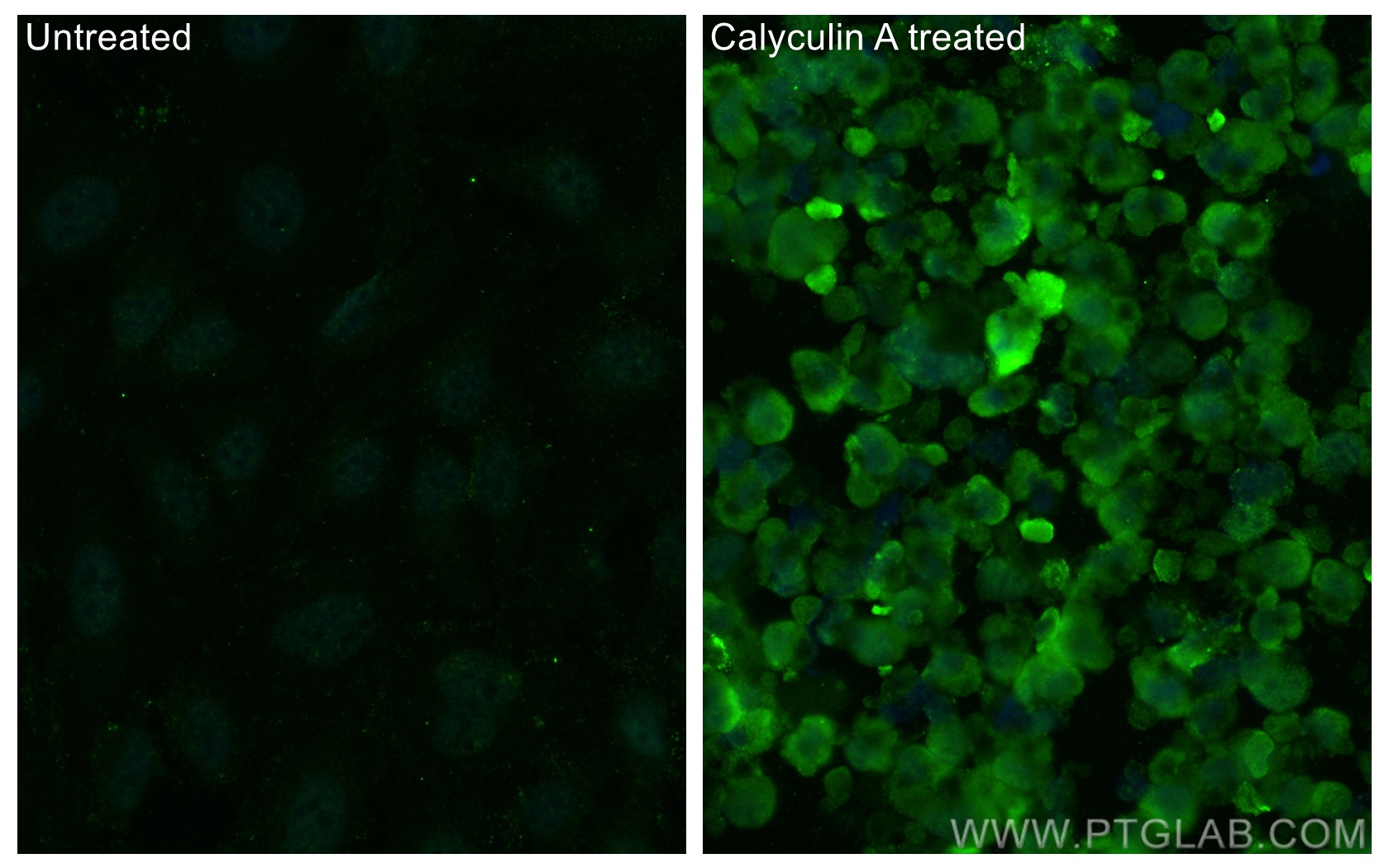 IF Staining of HeLa using 68015-1-Ig