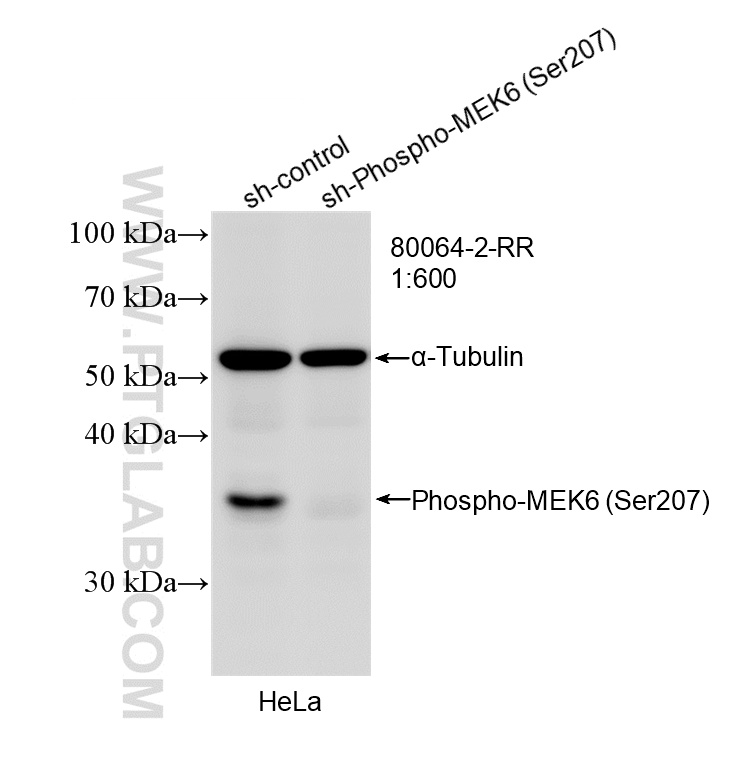 WB result of Phospho-MEK6 (Ser207) antibody (80064-2-RR; 1:600; incubated at room temperature for 1.5 hours) with sh-Control and sh-Phospho-MEK6 (Ser207) transfected HeLa cells. WB analysis of HeLa using 80064-2-RR