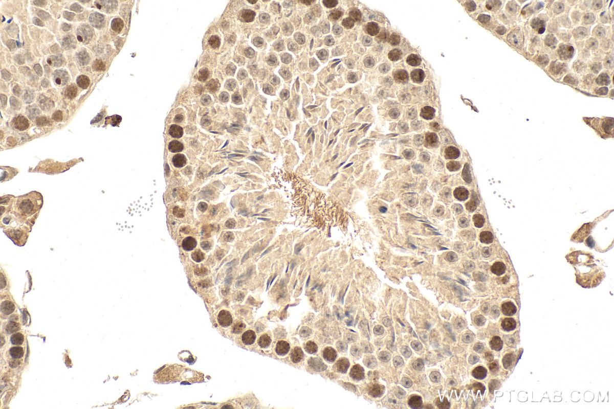 IHC staining of mouse testis using 81398-1-RR