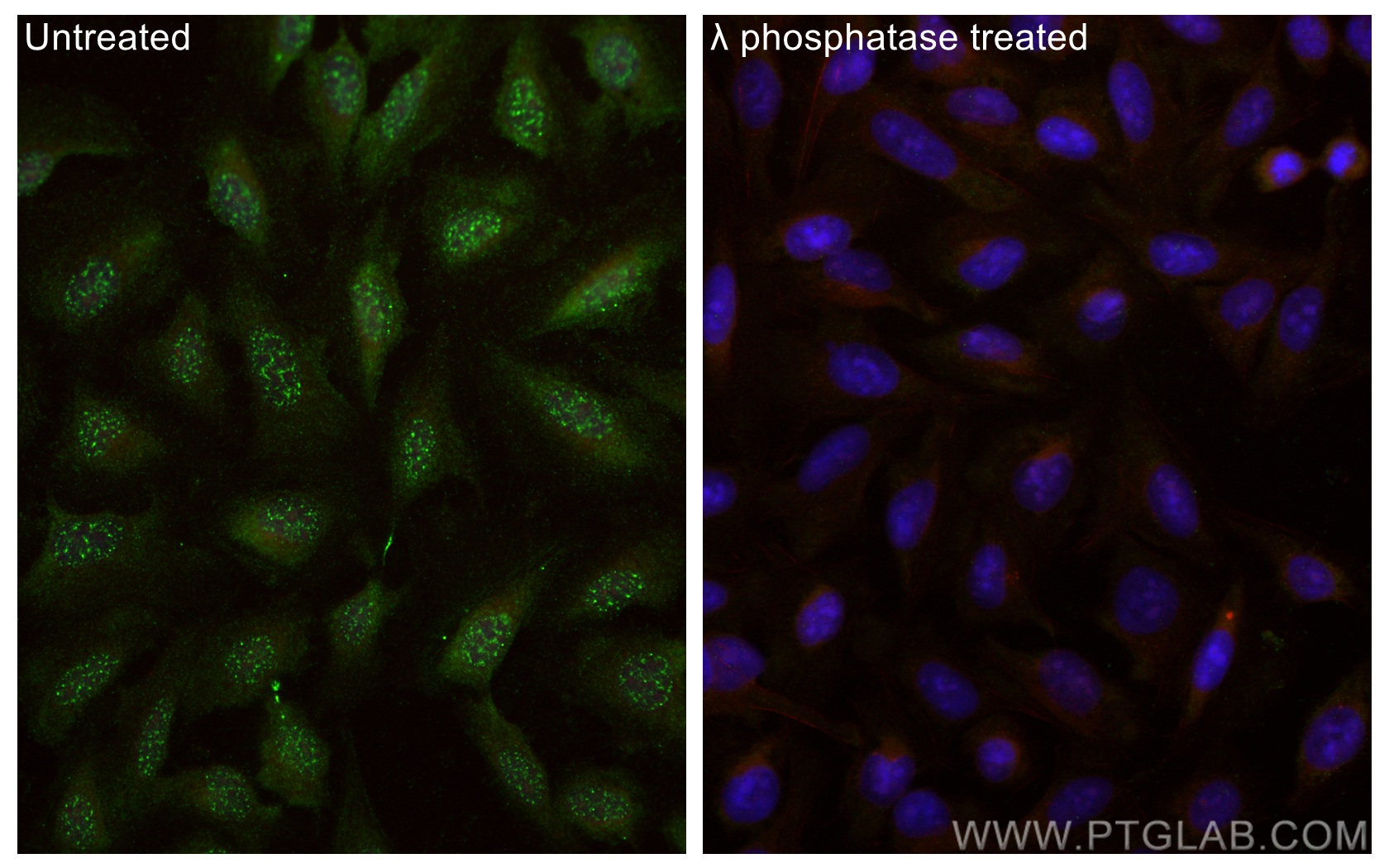 IF Staining of U2OS using 29027-1-AP