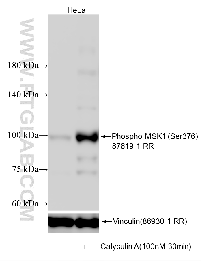 WB analysis using 87619-1-RR