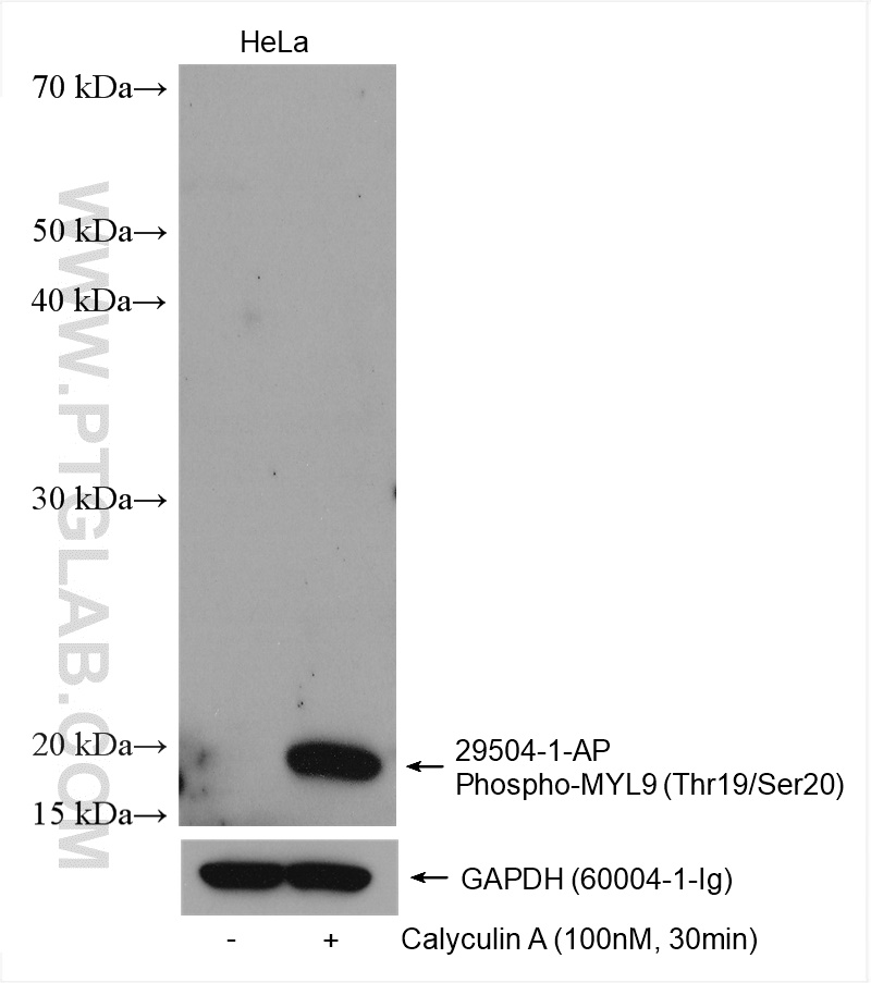 Phospho-MYL9 (Thr19/Ser20) 