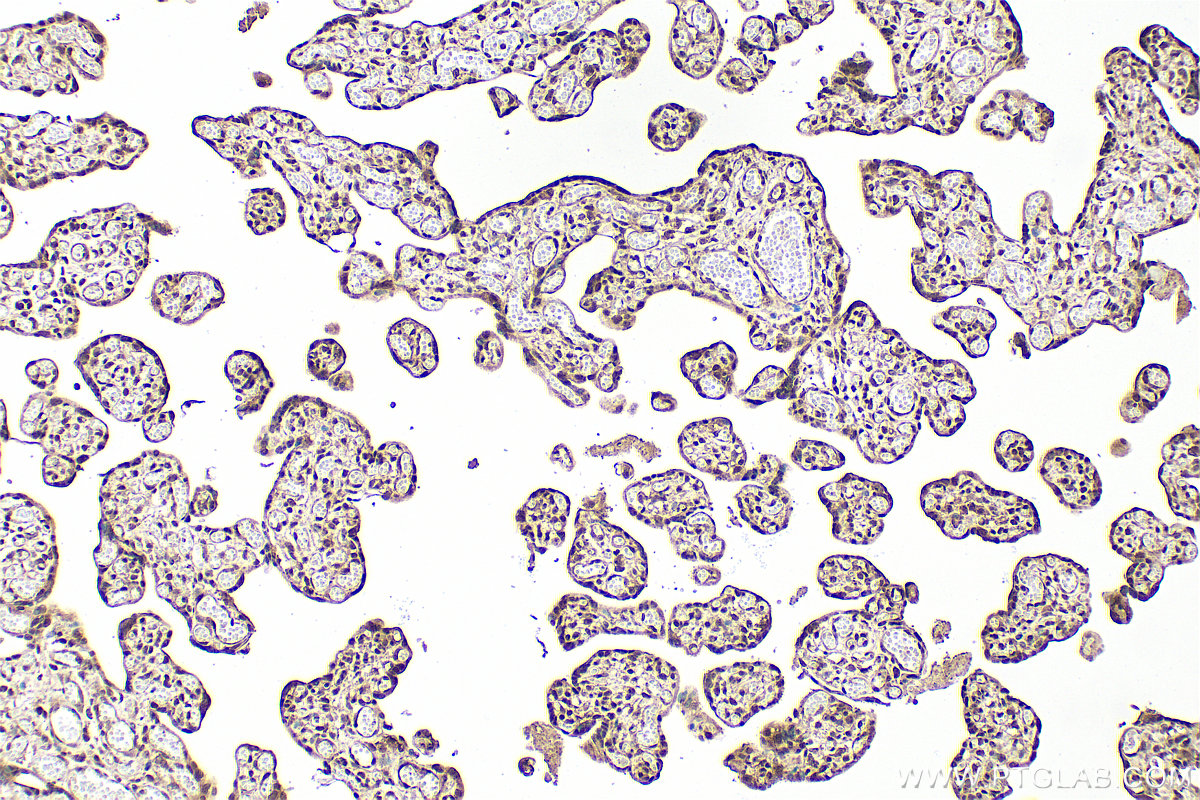 IHC staining of human placenta using 80379-2-RR IHC staining of human placenta using 80379-2-RR