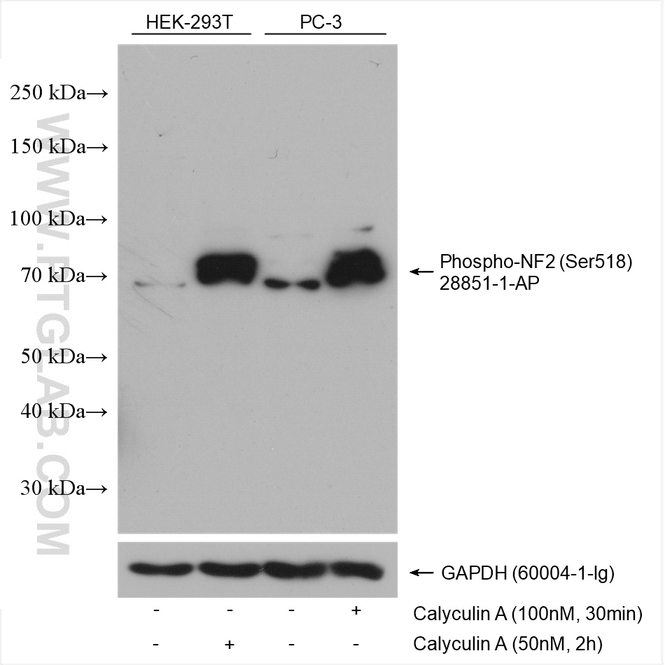 WB analysis using 28851-1-AP