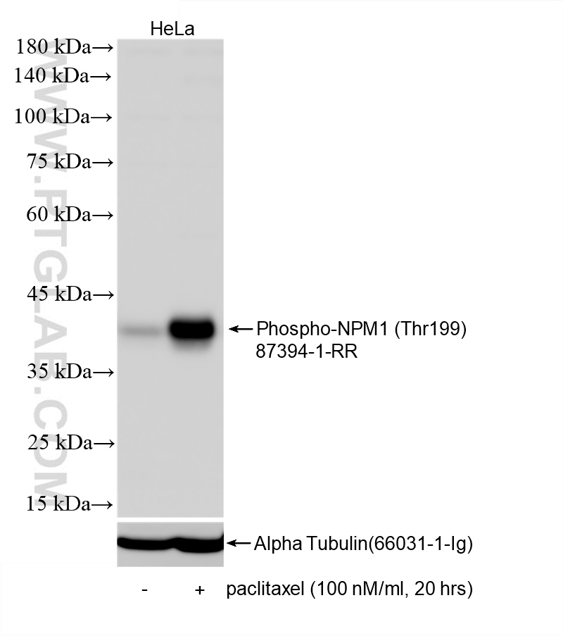 WB analysis of HeLa using 87394-1-RR (same clone as 87394-1-PBS) WB analysis of HeLa using 87394-1-RR (same clone as 87394-1-PBS)